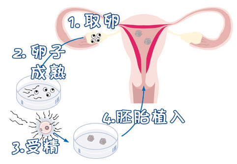 有偿孕妈借卵代怀咨询微信群